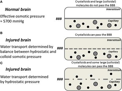 Aspects on the Physiological and Biochemical Foundations of Neurocritical Care